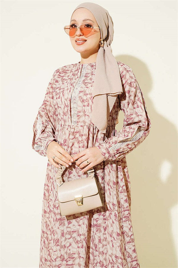 Lace-trimmed Cuff Button Dress, Beige