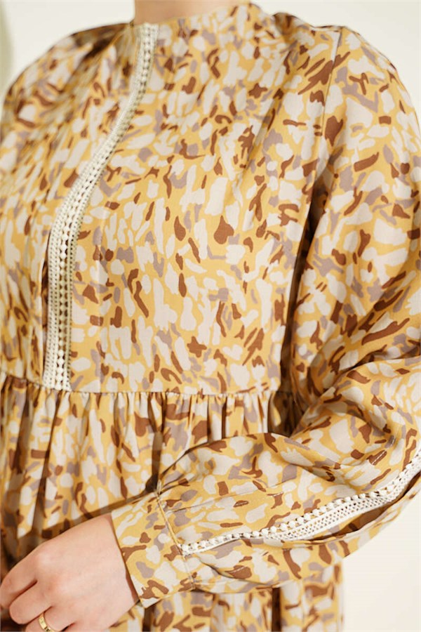 Mustard Dress with Lace Trim and Buttoned Cuffs