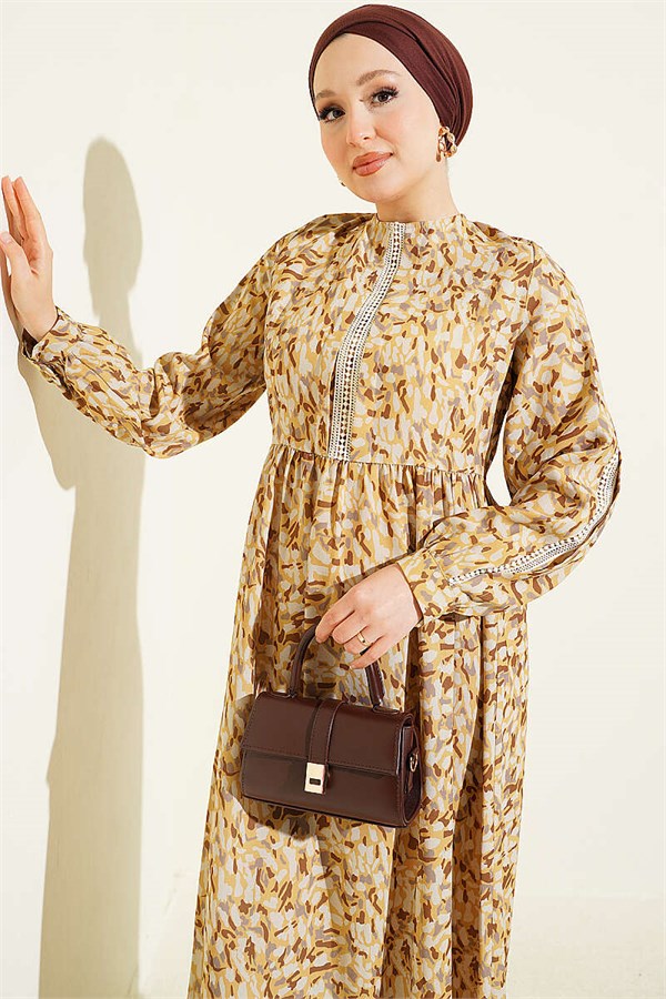Mustard Dress with Lace Trim and Buttoned Cuffs
