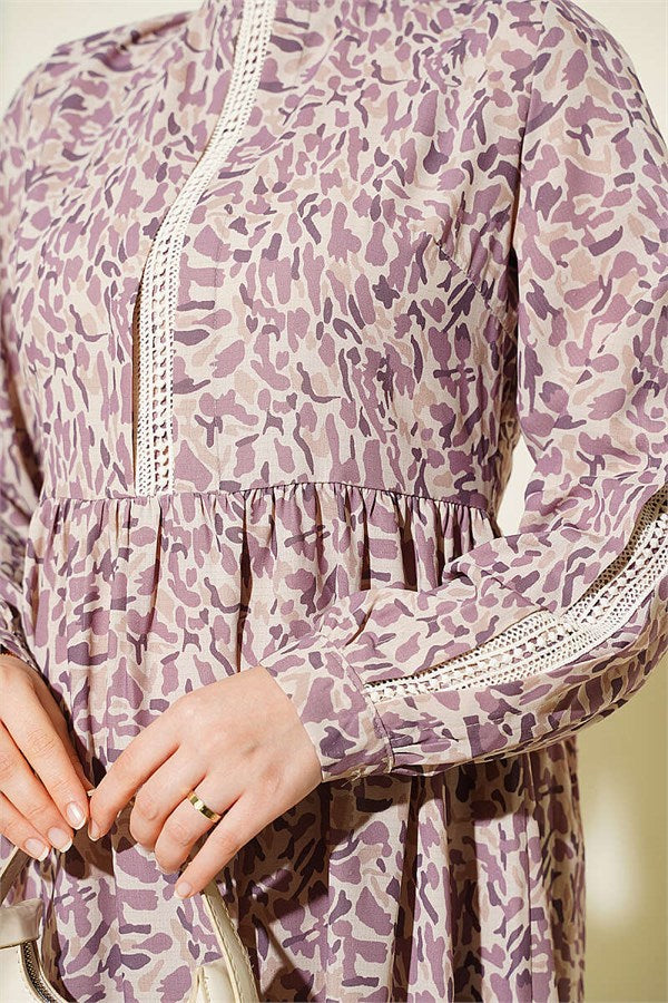 Lace-trimmed Cuff Button Dress Lilac